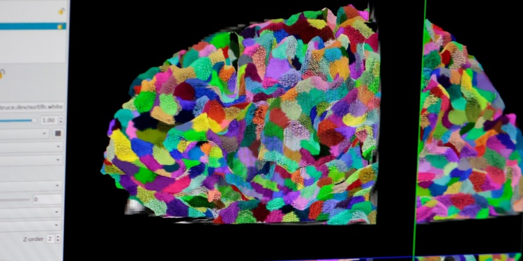 brain color