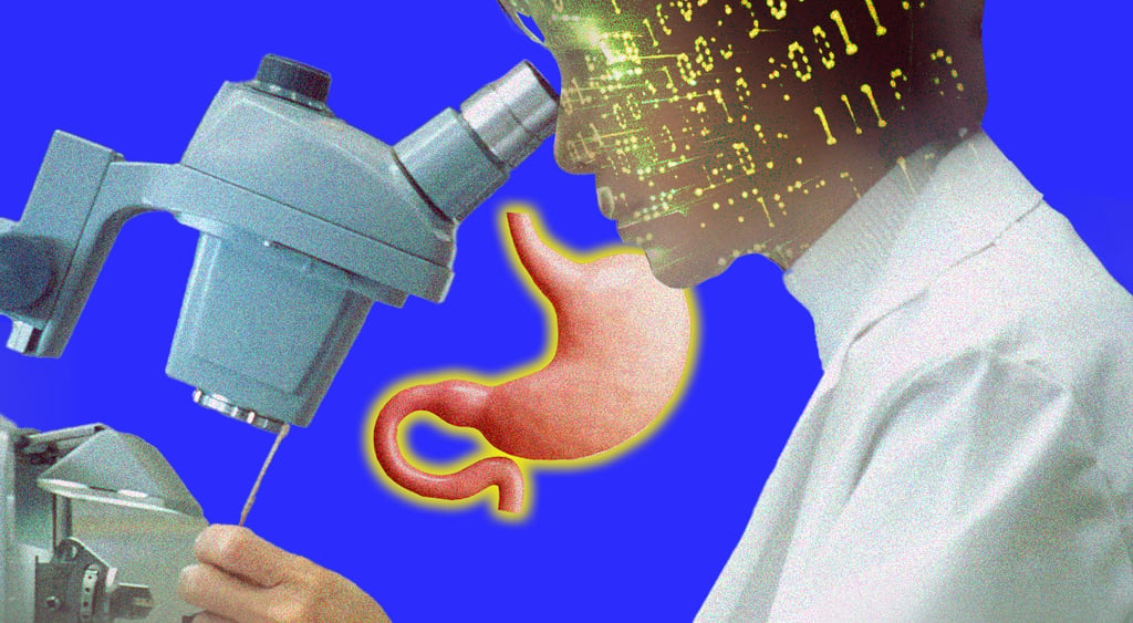 AI tool for stomach cancer