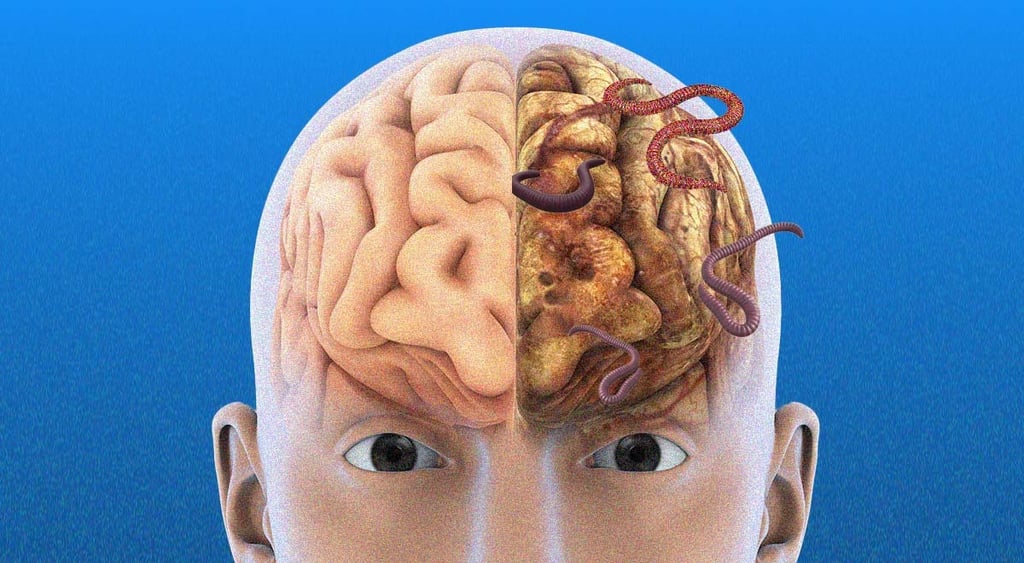 Brain