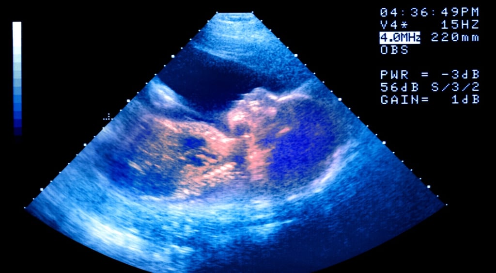 baby ultrasound on black monitor with blue lights around,