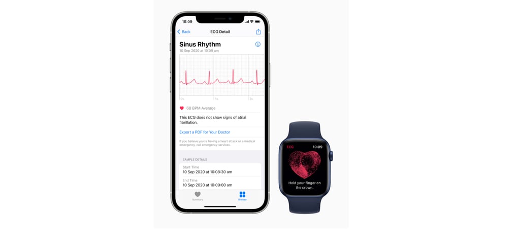 Heart Rate Monitoring