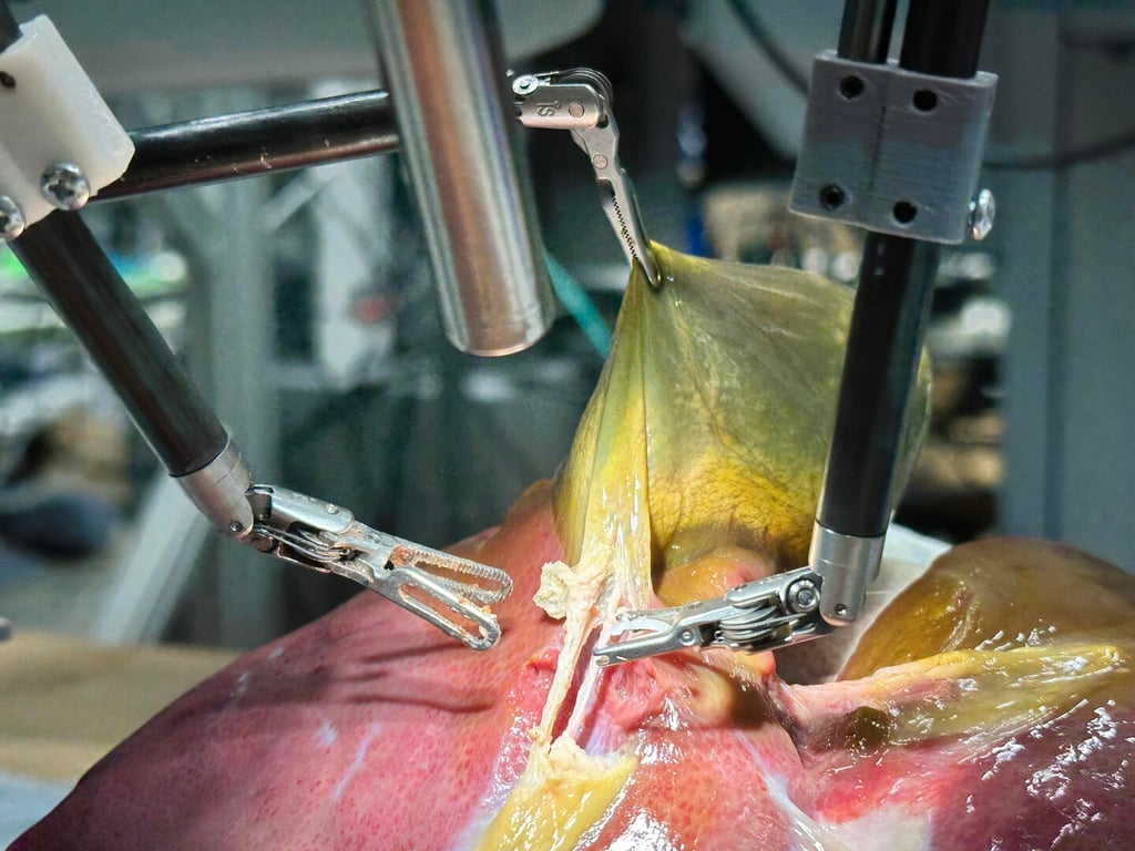 Robotic surgery