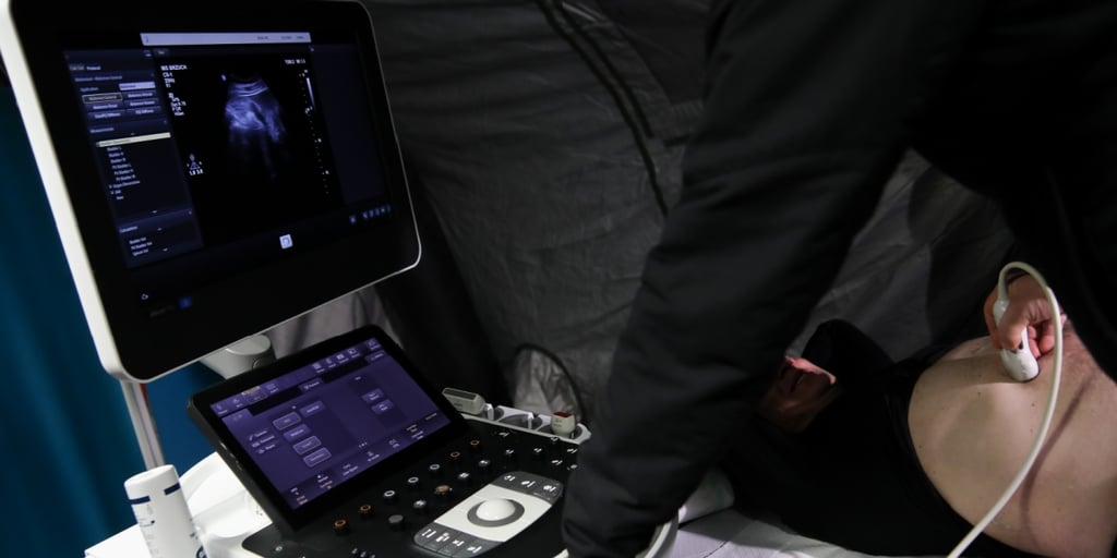 black shirt, ultrasound examination, white bald patient, naked belly, black monitor