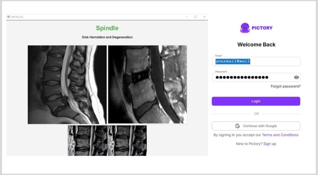Chosen Brick lures, MRI scans and Fake poctory app