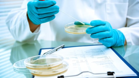 Germs growing on an agar plate in laboratory
