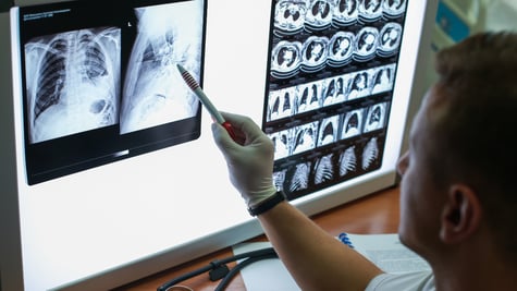 lung_scan