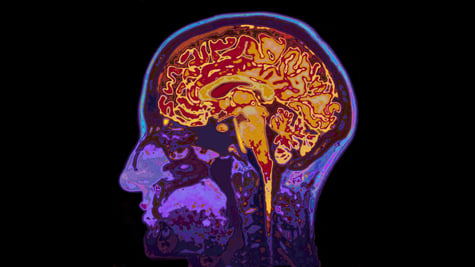 Brains