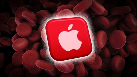 Apple blood sugar tech