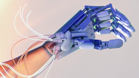 A prosthetic arm attached to a real arm
