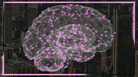 brain scan