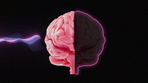 Brain rot