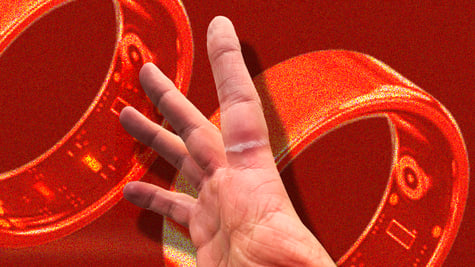 Smart ring marks on finger
