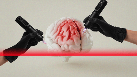 Eletronics tattoo that tracks brain activity
