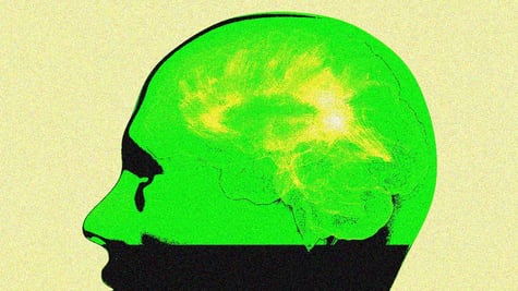 An AI brain in green and yellow.