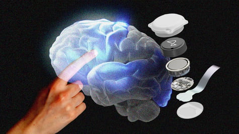 Neuralink brain implant