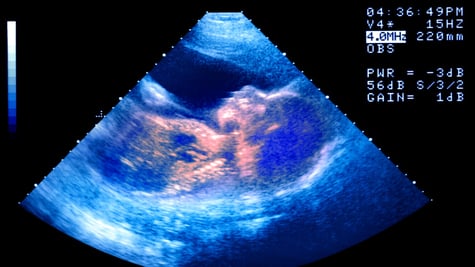 baby ultrasound on black monitor with blue lights around,