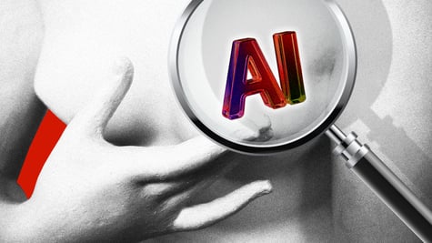 AI breast cancer