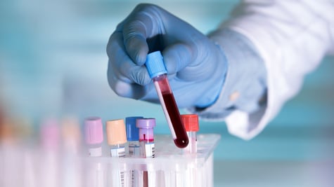 New York Blood Center data breach