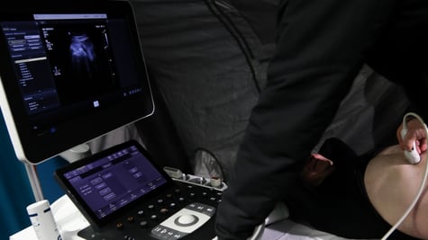 black shirt, ultrasound examination, white bald patient, naked belly, black monitor