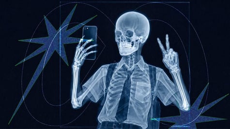 teenage skeleton age verification