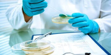 Germs growing on an agar plate in laboratory