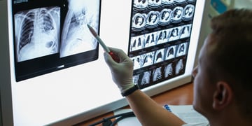 lung_scan