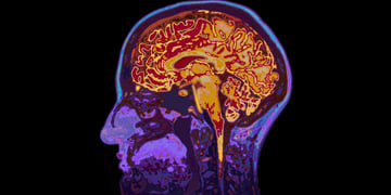 Brains