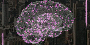 brain scan
