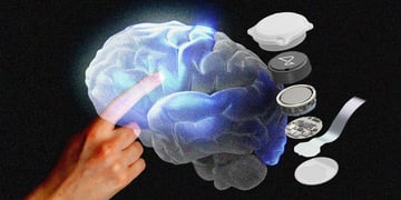 Neuralink brain implant
