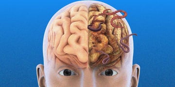 Rotten brains