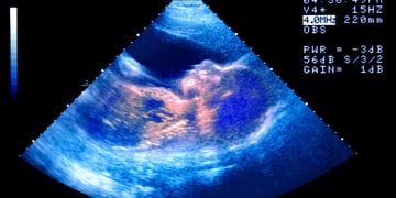 baby ultrasound on black monitor with blue lights around,