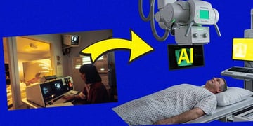 Patient undergoing a scan, radiologist analyzing it, letters "AI" in the middle